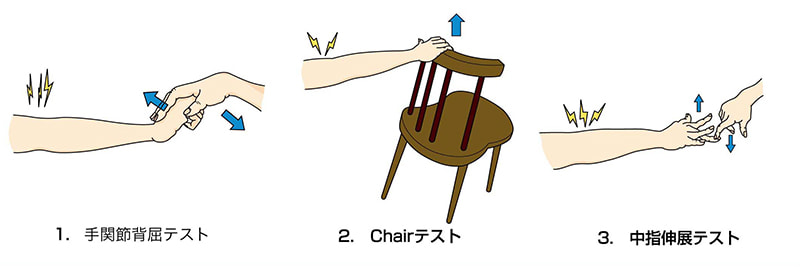 テニス肘(上腕骨外側上顆炎)