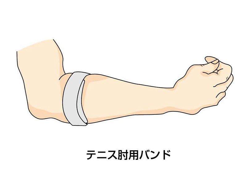 テニス肘(上腕骨外側上顆炎)